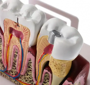 Model vilice studenta stomatologije podučavajući modele zuba za model zuba studenta stomatologije