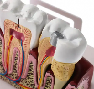 Dental student jaw model teaching tooth models for dentistry student teeth model