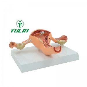 The medical school teaches the human model of pathological changes of female reproductive uterus and ovary