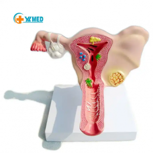 Factory Manufacture Medical Gynecology Poj Niam Ovarian Reproductive Structure Ovarian Uterus Model