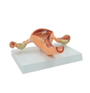 De medyske skoalle leart it minsklik model fan patologyske feroaringen fan froulike reproduktive uterus en eierstok