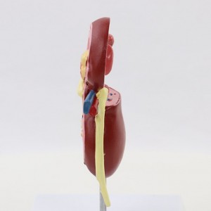 Medical Science Human Urinary System Disease Model for Teaching Use Class Tools Pathology Kidney Anatomy Model