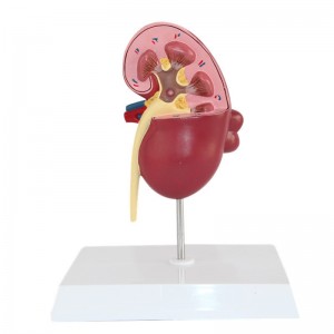 Medical Science Human Urinary System Disease Model for Teaching Use Class Tools Pathology Kidney Anatomy Model