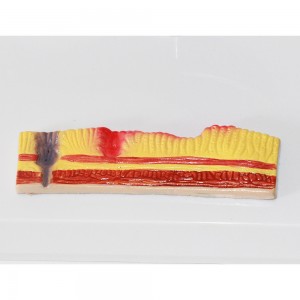 Clinic Display Medical School Anatomical Model Human Gastric Lesion Model Anatomy Pathological Stomach Model