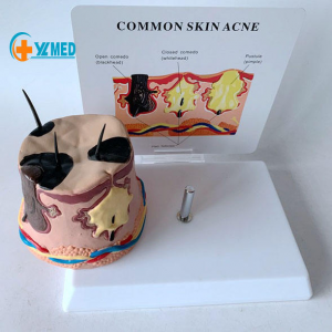 Best Selling Anatomical Human Structure Skin Model for Teaching Model