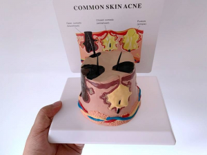 Human Pathological Round Skin Model Abscess Inflamed Skin Enlarged Hair Growth Process Skin Pouch Construction Model
