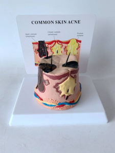 Human Pathological Round Skin Model Abscess Inflamed Skin Enlarged Hair Growth Process Skin Pouch Construction Model