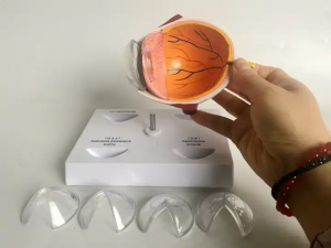 Human eye structure teaching model Eye anatomy model Ocular lens disease demonstration teaching