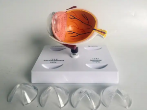 Human eye structure teaching model Eye anatomy model Ocular lens disease demonstration teaching