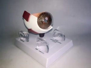 Human eye structure teaching model Eye anatomy model Ocular lens disease demonstration teaching