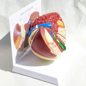 Human Pathological Liver Model Anatomical Model Pathological Liver Features for Medical School Study and Research