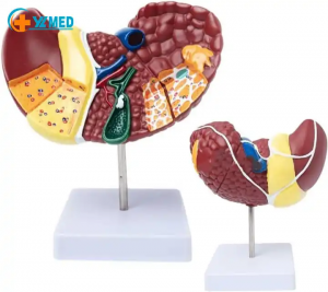 Human Pathological Liver Model Anatomical Model Pathological Liver Features for Medical School Study and Research