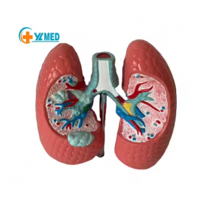 Medical Science Human Healthy Lung Compared with Sick Lung Contrast Model Internal Organ Dissection Demonstration Teaching