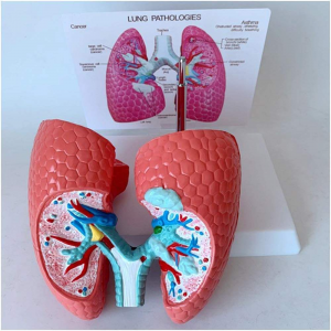 Medical Science Human Healthy Lung Compared with Sick Lung Contrast Model Internal Organ Dissection Demonstration Teaching