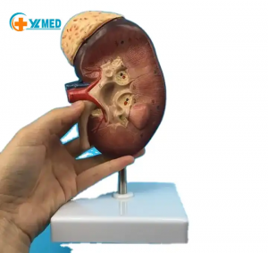 Warmverkopende fabriek direkte voorsiening nier anatomiese model mediese orgaan onderwys model menslike plastiek nier model 2X groot