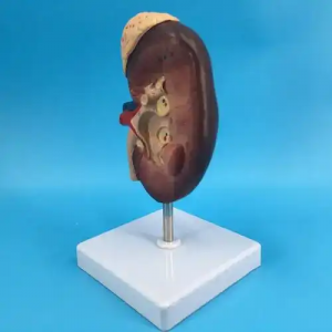 Hot selling factory direct supply kidney anatomical model medical organ education model human plastic kidney model 2X large