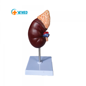 Renal anatomy with adrenal gland model