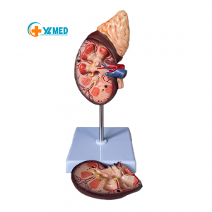 Renal anatomy with adrenal gland model