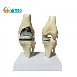 2025 New Detachable Artificial Small Double Silver Knee Joint Implant Model Set Manikin for Knee Prosthesis
