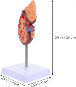 Skin Model 35X Enlarged Anatomical Skin Model Skin Layer Structure Model with Hair 3 Dimensional Skin Teaching Tool for Learning Teaching