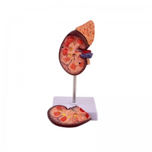 Skin Model 35X Enlarged Anatomical Skin Model Skin Layer Structure Model with Hair 3 Dimensional Skin Teaching Tool for Learning Teaching