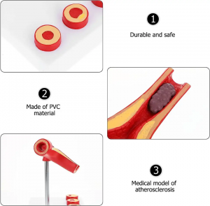 Human Atherosclerosis Cardiovascular Medical Model ea Mali ea Vessel Anatomical Model ea Lithupelo tsa Bongaka bakeng sa Liithuti tsa Sekolo