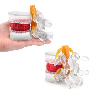 Human Transparent Lumbar Spine 1.5 Times Spine for Student Demonstration Lumbar Disc Protrusion Bone CE/ISO Certification
