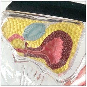Medical Science Educational Equipment Female Reproductive System Model Human Anatomical Models Transparent Uterus Model